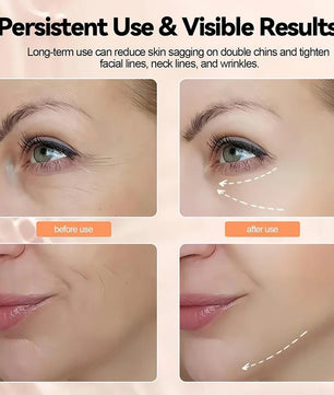 Face Neck Lifting Beauty Device Hot Compress 5-color LED Photon Firming Rejuvenation Anti Wrinkle Reduce Double Chin Anti Facial