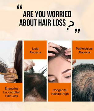 PURC Ginger Hair Growth Oil Fast Hair Loss Treatment Smoothing Repair