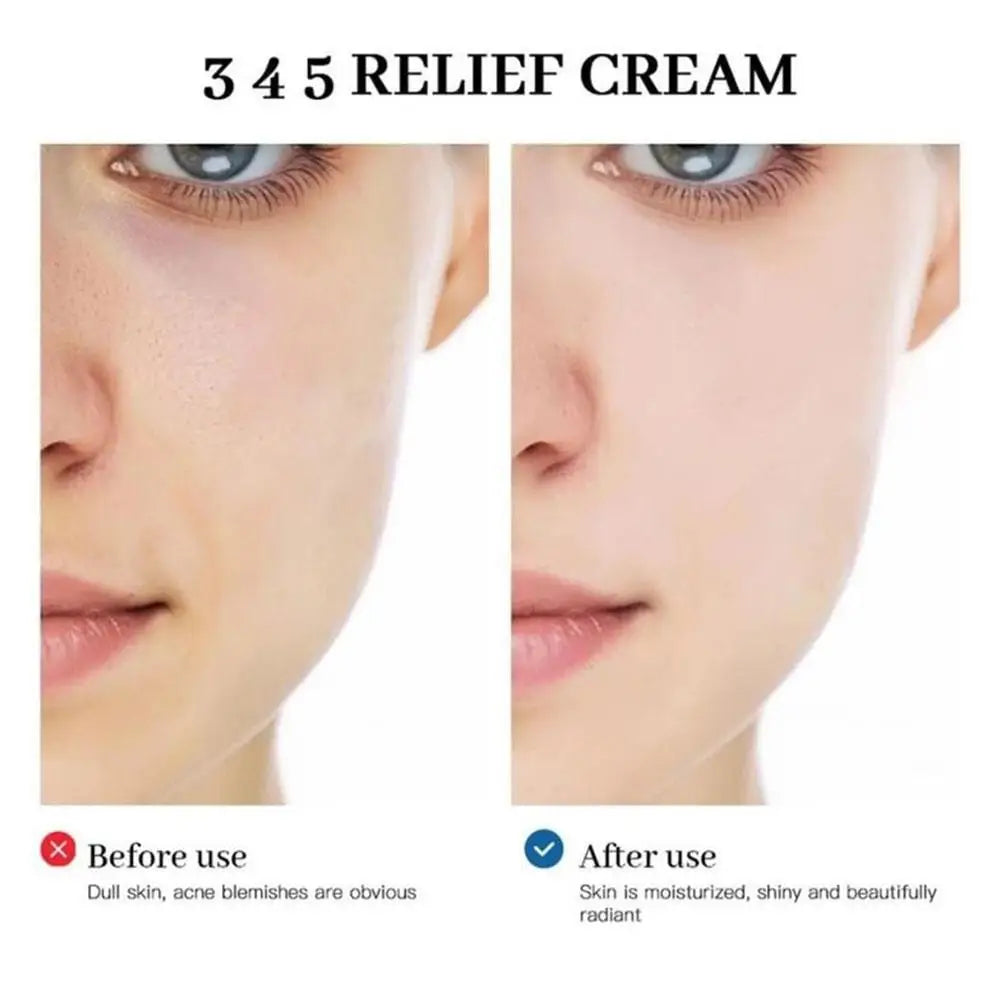 Dr.Althea 345 Relief Face Cream Address Blemishes Nourishing Skin