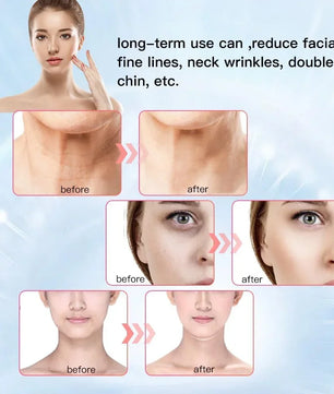 Face Neck Lifting Beauty Device Hot Compress 5-color LED Photon Firming Rejuvenation Anti Wrinkle Reduce Double Chin Anti Facial