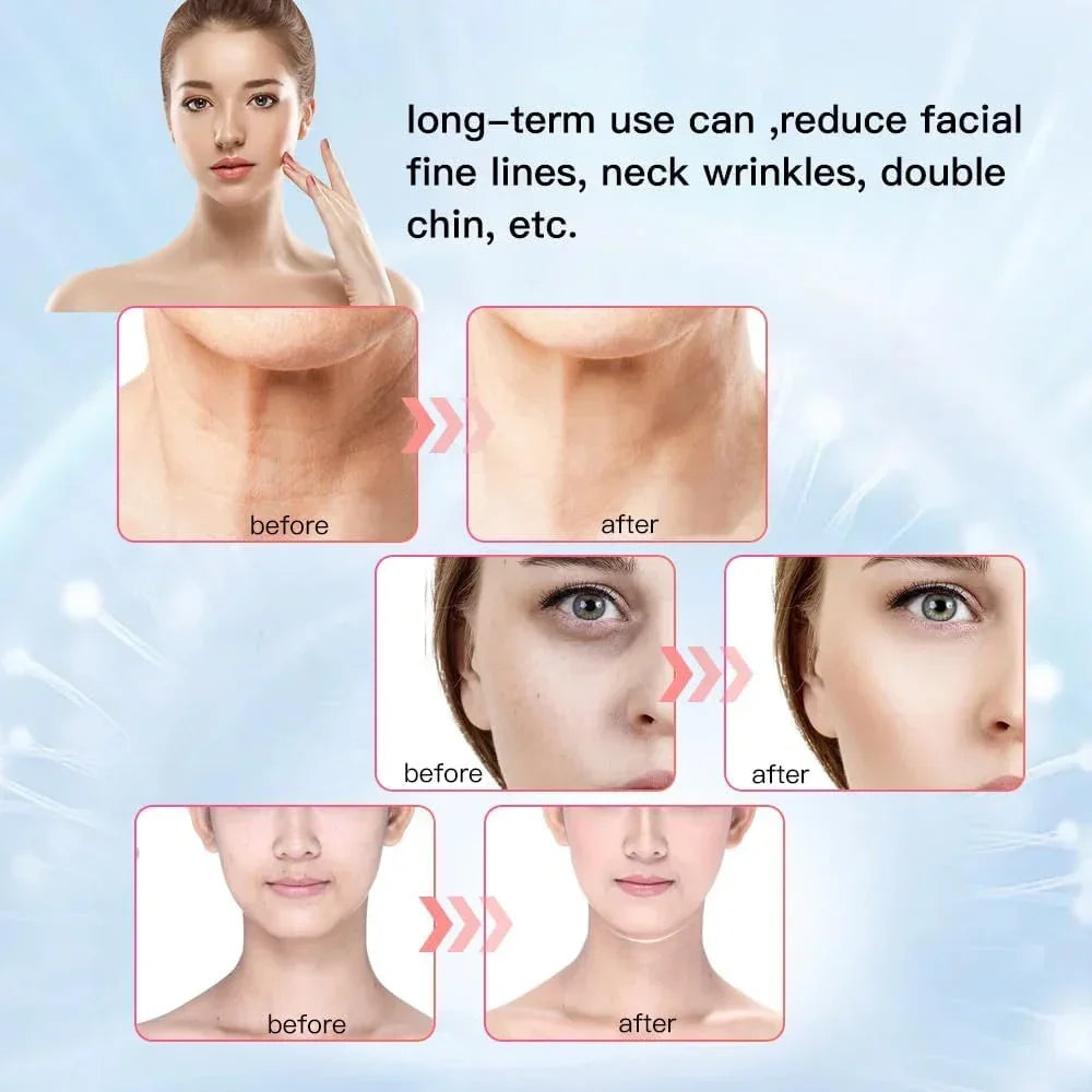 Face Neck Lifting Beauty Device Hot Compress 5-color LED Photon Firming Rejuvenation Anti Wrinkle Reduce Double Chin Anti Facial