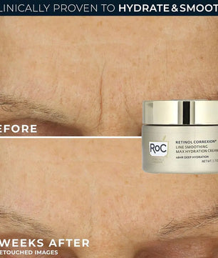 48g Retinol Cream Smooth Collagen Peptide Face Moisturizing Firming