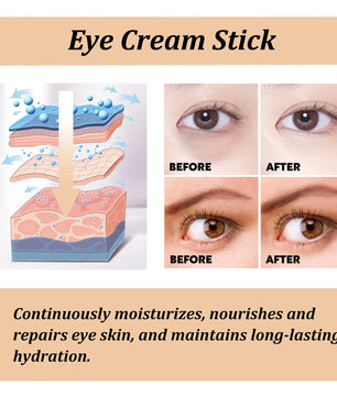 Snail Eye Cream Stick Collagen Fade Fine Lines Wrinkle Lightening Dark Circles