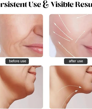 Face Neck Lifting Beauty Device Hot Compress 5-color LED Photon Firming Rejuvenation Anti Wrinkle Reduce Double Chin Anti Facial