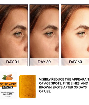 Turmeric Soap Face Cleansing Anti Acne Whitening Skin Lightening Face Remove