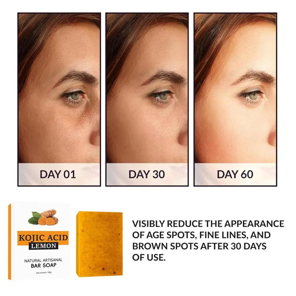Turmeric Soap Face Cleansing Anti Acne Whitening Skin Lightening Face Remove
