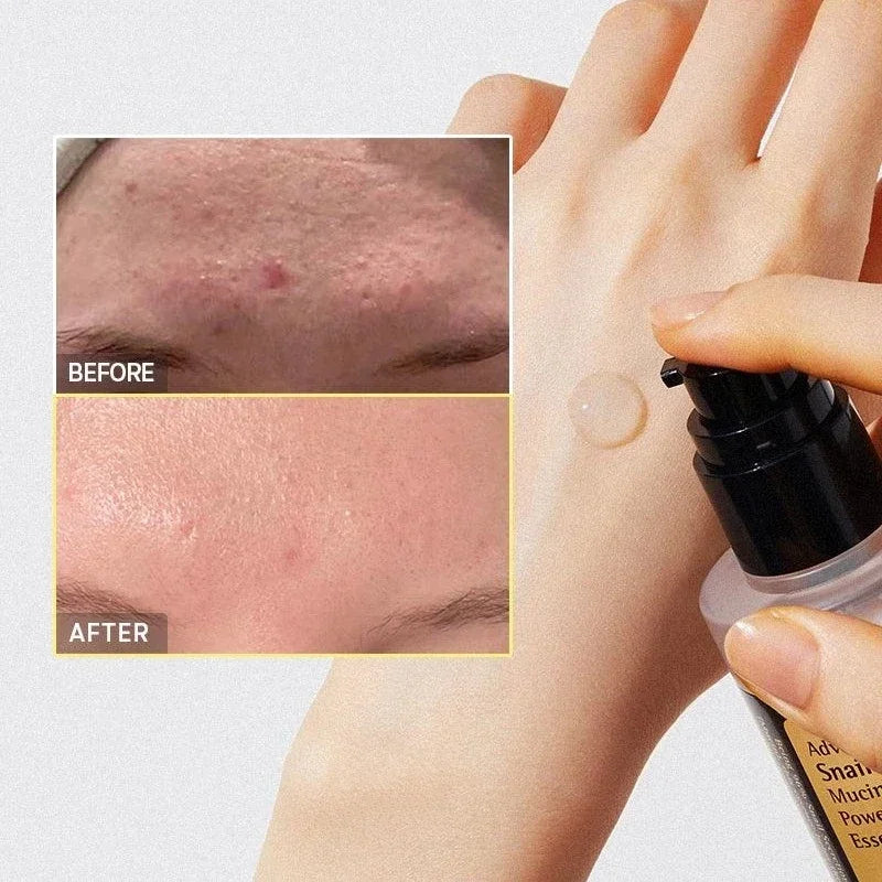 Snail Collagen Face Cream/Repair Essence Moisturizing Lifting Firming